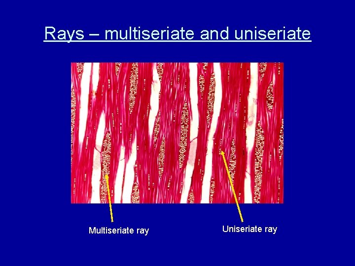 Rays – multiseriate and uniseriate Multiseriate ray Uniseriate ray 