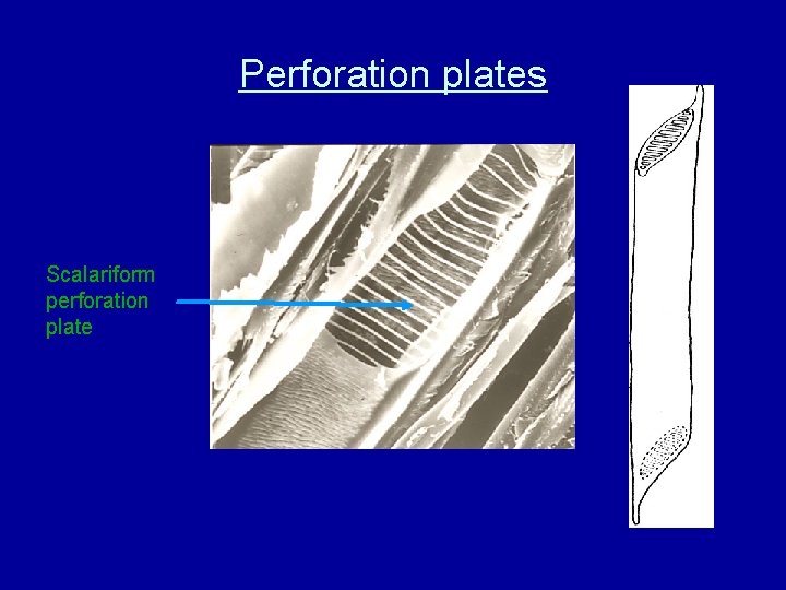 Perforation plates Scalariform perforation plate 