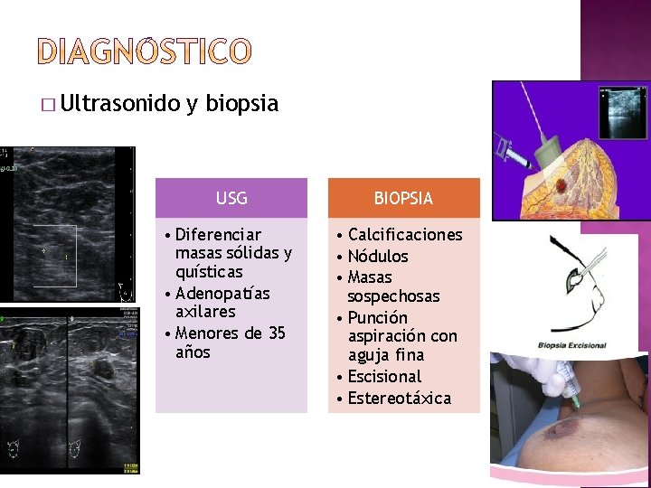 � Ultrasonido y biopsia USG BIOPSIA • Diferenciar masas sólidas y quísticas • Adenopatías