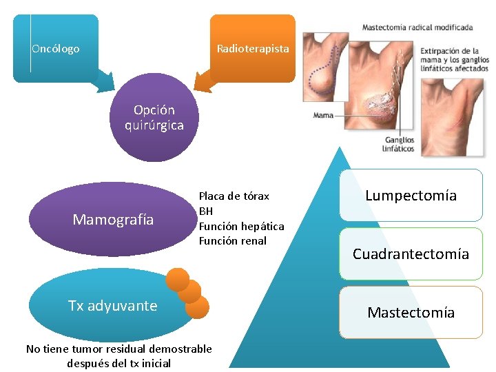 Oncólogo Radioterapista Opción quirúrgica Mamografía Placa de tórax BH Función hepática Función renal Tx