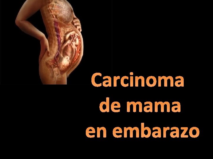 Carcinoma de mama en embarazo 