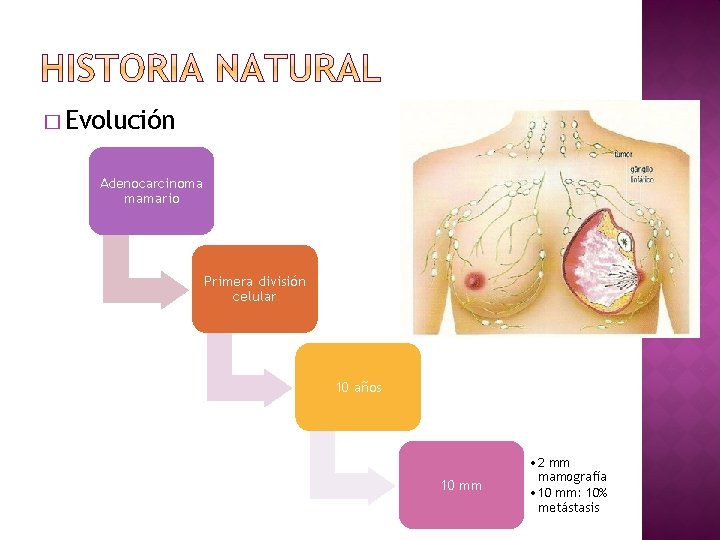 � Evolución Adenocarcinoma mamario Primera división celular 10 años 10 mm • 2 mm