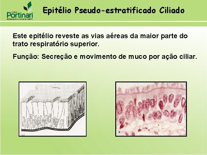 Epitélio Pseudo-estratificado Ciliado Este epitélio reveste as vias aéreas da maior parte do trato