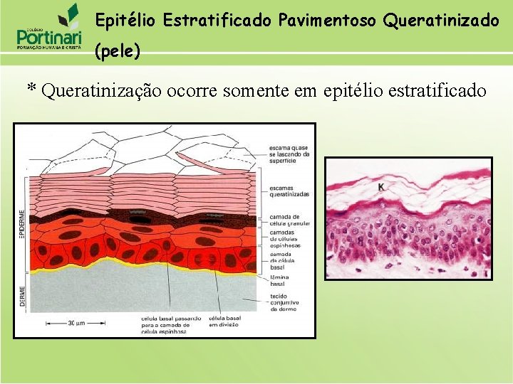 Epitélio Estratificado Pavimentoso Queratinizado (pele) * Queratinização ocorre somente em epitélio estratificado 