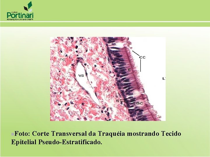 Foto: Corte Transversal da Traquéia mostrando Tecido Epitelial Pseudo-Estratificado. n 