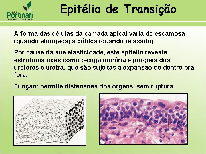 Epitélio de Transição A forma das células da camada apical varia de escamosa (quando
