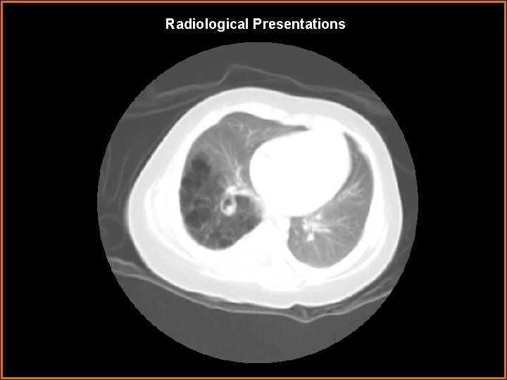 Radiological Presentations 