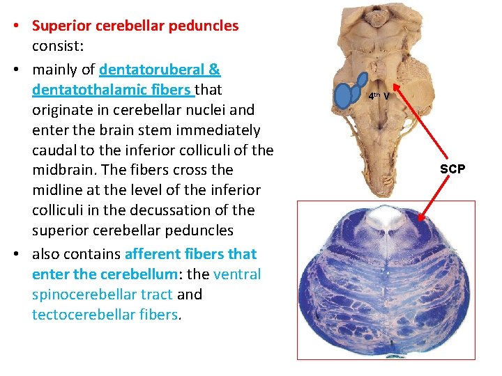 • Superior cerebellar peduncles consist: • mainly of dentatoruberal & dentatothalamic fibers that