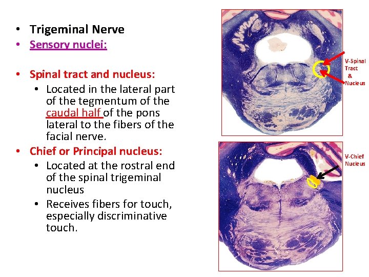  • Trigeminal Nerve • Sensory nuclei: • Spinal tract and nucleus: • Located