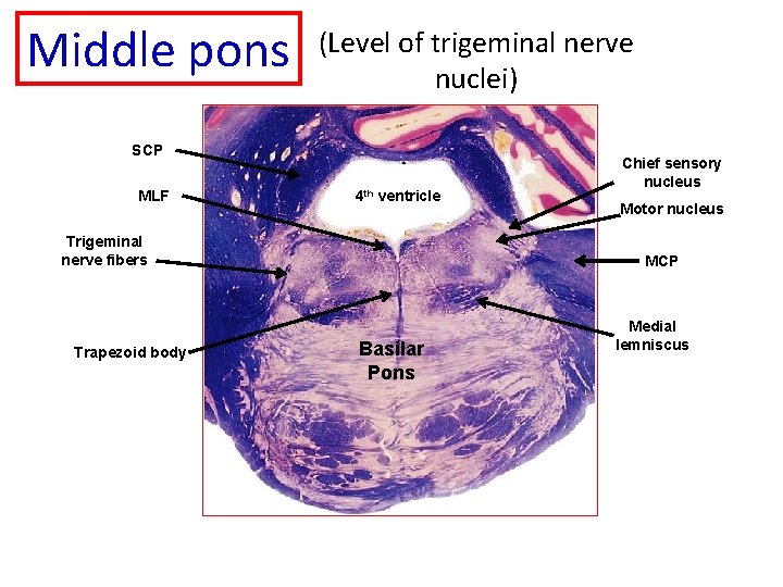 Middle pons (Level of trigeminal nerve nuclei) SCP MLF 4 th ventricle Motor nucleus