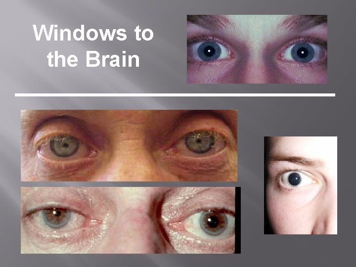 Windows to the Brain 
