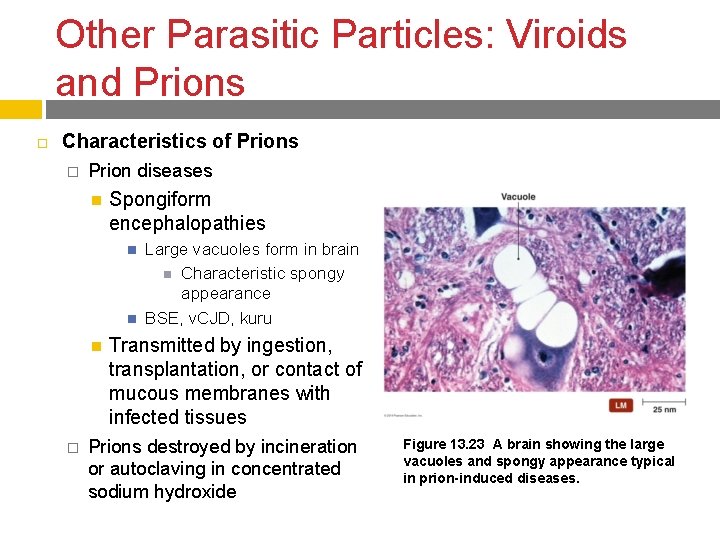 Other Parasitic Particles: Viroids and Prions Characteristics of Prions � Prion diseases Spongiform encephalopathies