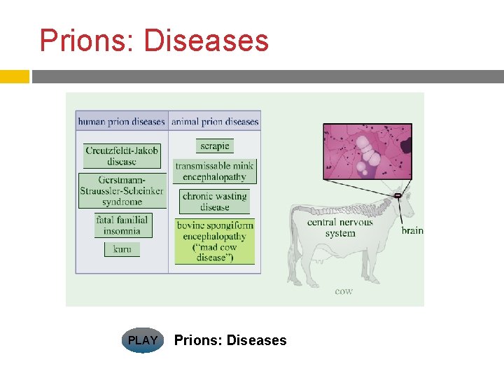 Prions: Diseases PLAY Prions: Diseases 