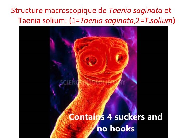 Structure macroscopique de Taenia saginata et Taenia solium: (1=Taenia saginata, 2=T. solium) Structure macroscopique de Taenia saginata et Taenia solium: (1=Taenia saginata, 2=T. solium)