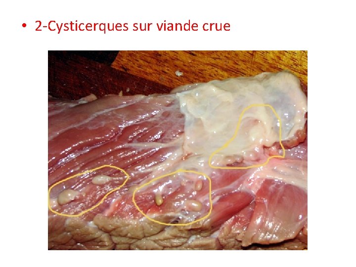 • 2 -Cysticerques sur viande crue • 2 -Cysticerques sur viande crue