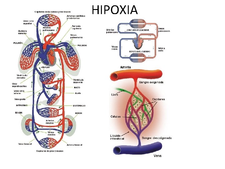 HIPOXIA 