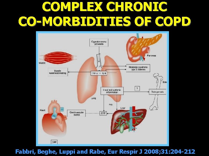 COMPLEX CHRONIC CO-MORBIDITIES OF COPD Fabbri, Beghe, Luppi and Rabe, Eur Respir J 2008;