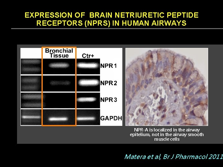 EXPRESSION OF BRAIN NETRIURETIC PEPTIDE RECEPTORS (NPRS) IN HUMAN AIRWAYS NPR-A is localized in