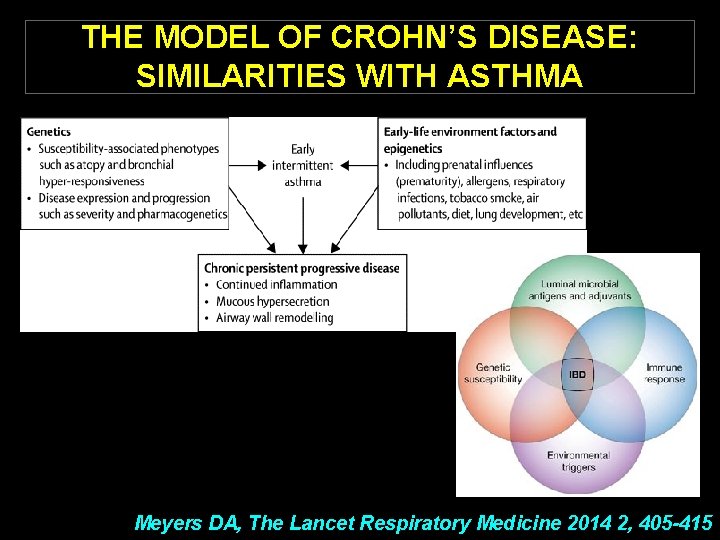 THE MODEL OF CROHN’S DISEASE: SIMILARITIES WITH ASTHMA Meyers DA, The Lancet Respiratory Medicine