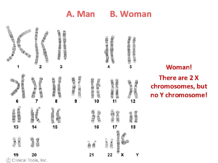 A. Man B. Woman! There are 2 X chromosomes, but no Y chromosome! 