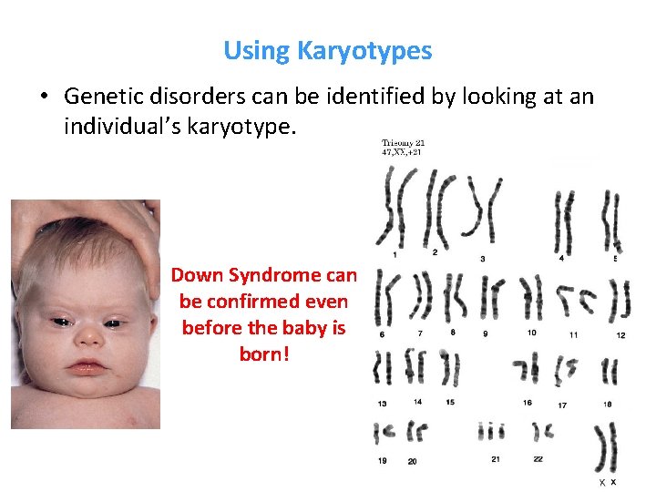 Using Karyotypes • Genetic disorders can be identified by looking at an individual’s karyotype.