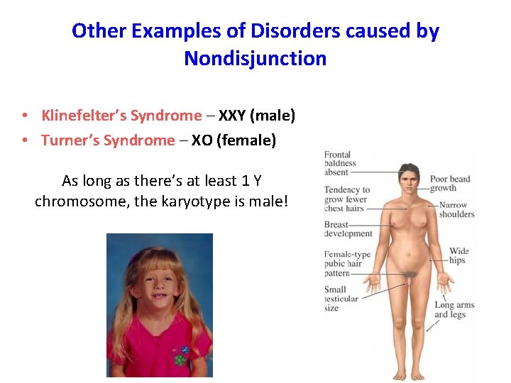 Other Examples of Disorders caused by Nondisjunction • Klinefelter’s Syndrome – XXY (male) •