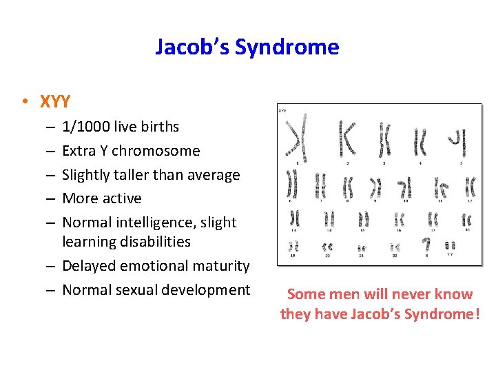 Jacob’s Syndrome • XYY 1/1000 live births Extra Y chromosome Slightly taller than average