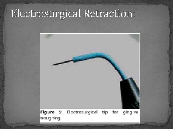 Electrosurgical Retraction: 