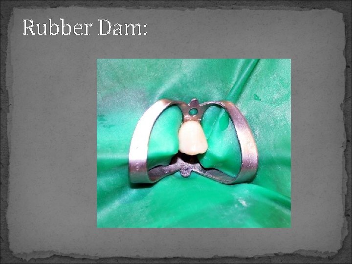 Rubber Dam: 