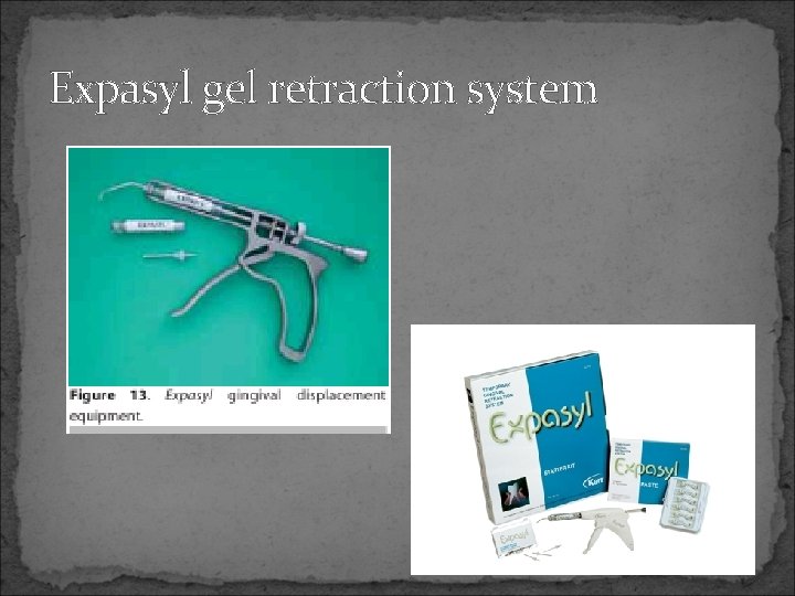 Expasyl gel retraction system 