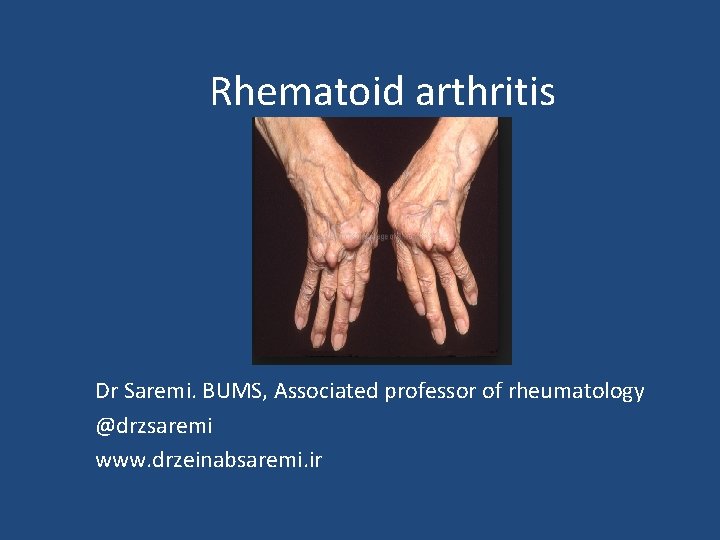 Rhematoid arthritis Dr Saremi. BUMS, Associated professor of rheumatology @drzsaremi www. drzeinabsaremi. ir 