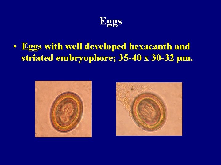 Eggs • Eggs with well developed hexacanth and striated embryophore; 35 -40 x 30