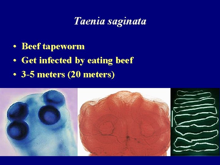Taenia saginata • Beef tapeworm • Get infected by eating beef • 3 -5