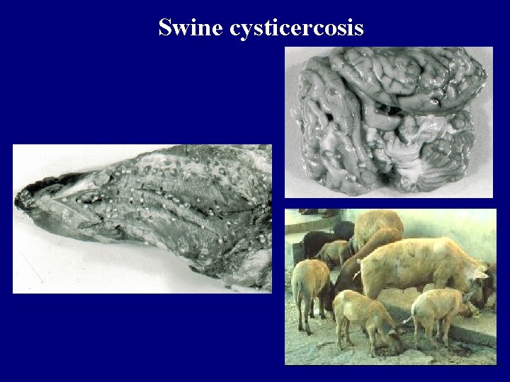 Swine cysticercosis 