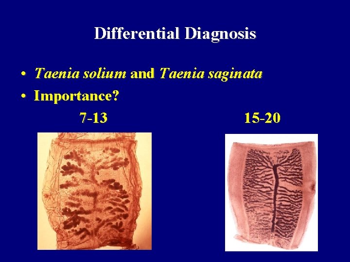 Differential Diagnosis • Taenia solium and Taenia saginata • Importance? 7 -13 15 -20