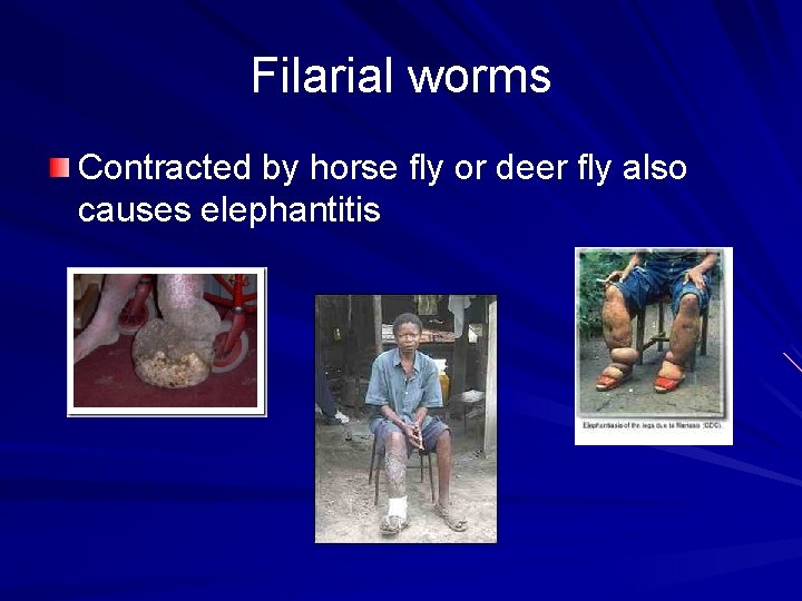 Filarial worms Contracted by horse fly or deer fly also causes elephantitis 