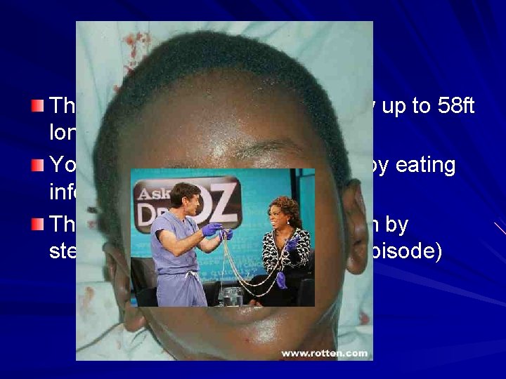 Tapeworms The largest tapeworms can grow up to 58 ft long You can become