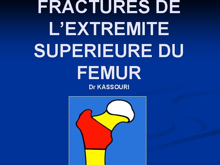 FRACTURES DE L’EXTREMITE SUPERIEURE DU FEMUR Dr KASSOURI 