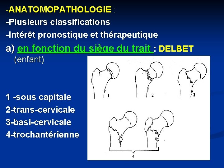 -ANATOMOPATHOLOGIE : -Plusieurs classifications -Intérêt pronostique et thérapeutique a) en fonction du siège du