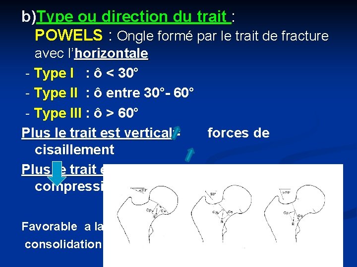 b)Type ou direction du trait : POWELS : Ongle formé par le trait de