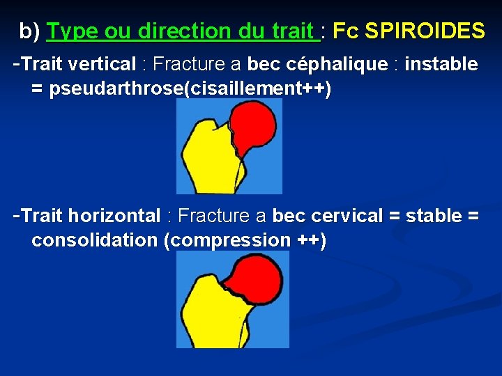 b) Type ou direction du trait : Fc SPIROIDES -Trait vertical : Fracture a