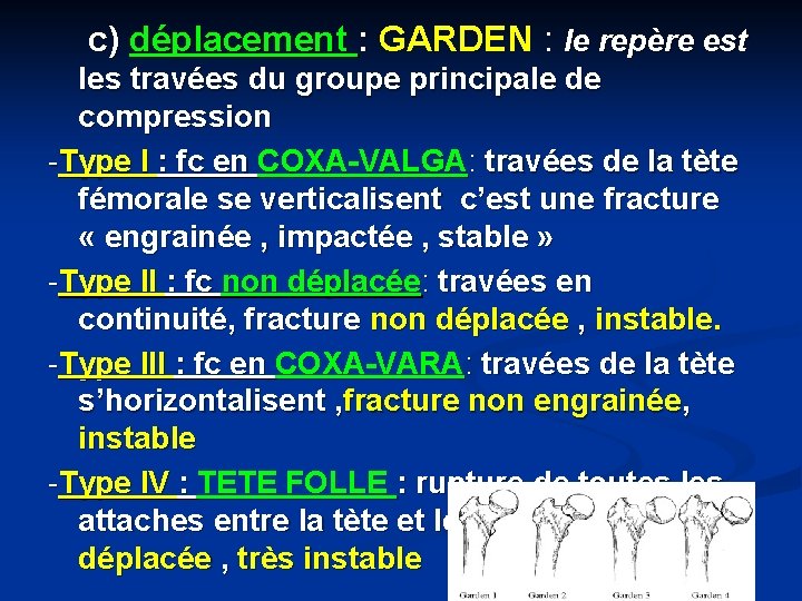 c) déplacement : GARDEN : le repère est les travées du groupe principale de