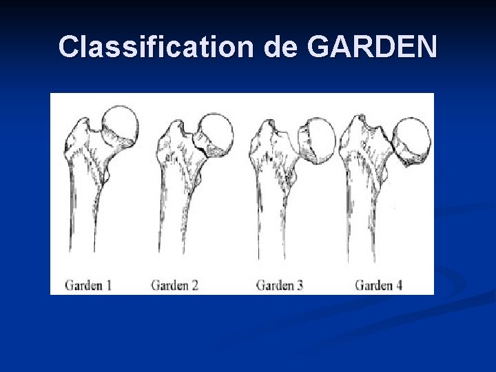Classification de GARDEN 