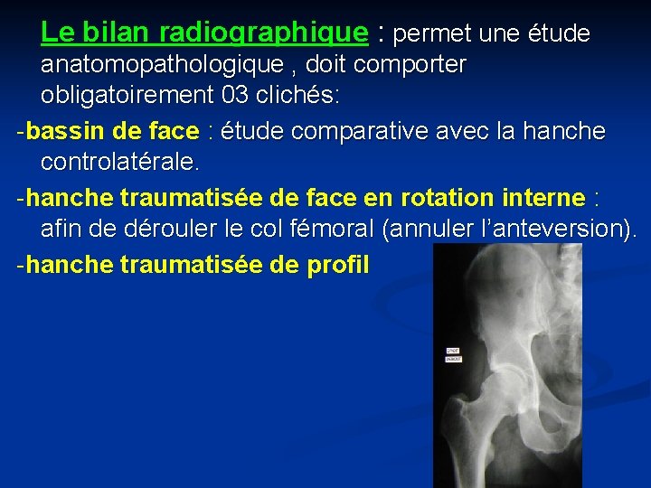 Le bilan radiographique : permet une étude anatomopathologique , doit comporter obligatoirement 03 clichés:
