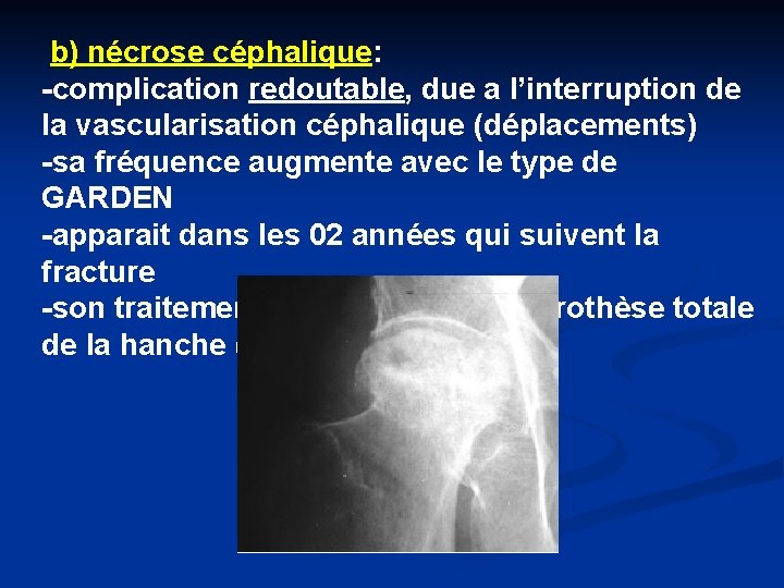b) nécrose céphalique: -complication redoutable, due a l’interruption de la vascularisation céphalique (déplacements) -sa