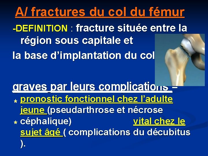 A/ fractures du col du fémur -DEFINITION : fracture située entre la région sous