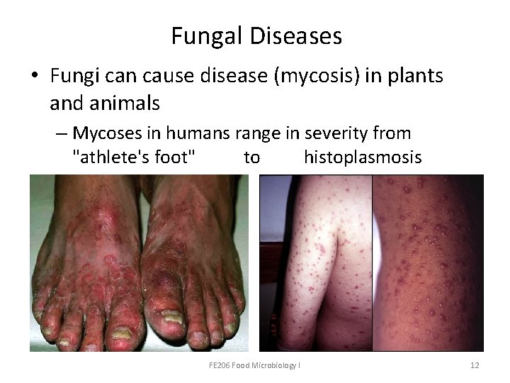 Fungal Diseases • Fungi can cause disease (mycosis) in plants and animals – Mycoses