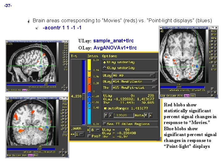 -37 - G Brain areas corresponding to “Movies” (reds) vs. “Point-light displays” (blues) å