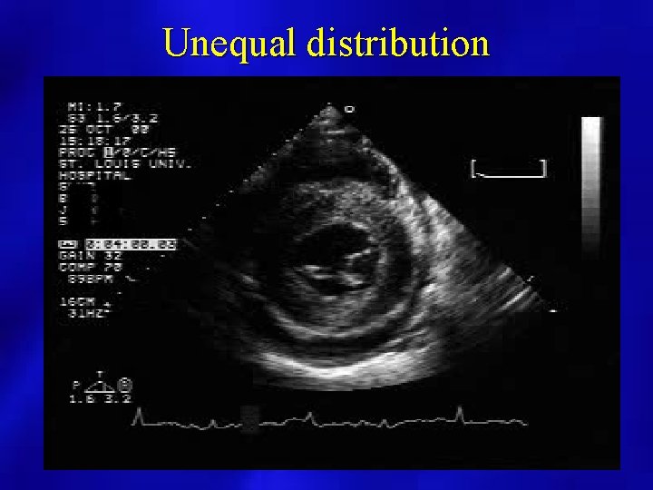 Unequal distribution 