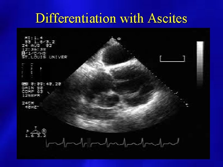Differentiation with Ascites 
